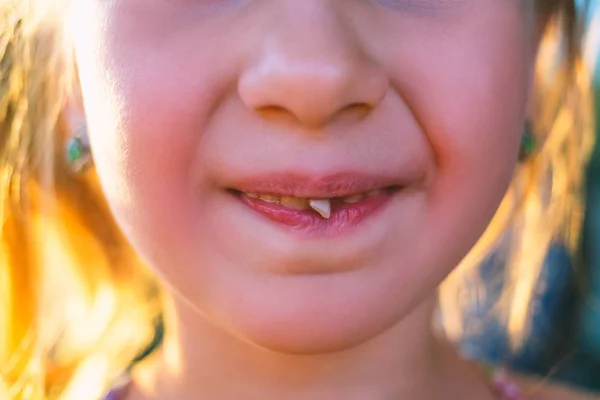 Portrait Little Girl Outstretched Milk Tooth — Stock Photo, Image