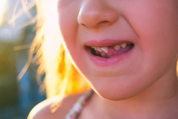 Portrait Little Girl Outstretched Milk Tooth — Stock Photo, Image