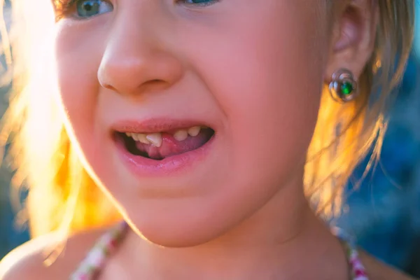 Portret Dziewczynki Rozciągniętym Mlecznym Zębem — Zdjęcie stockowe