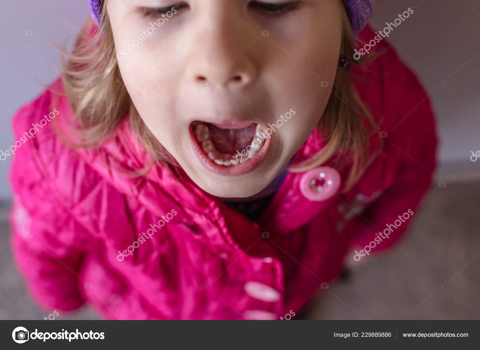 Adult Permanent Teeth Coming Baby Teeth Shark Teeth Opened Mouth