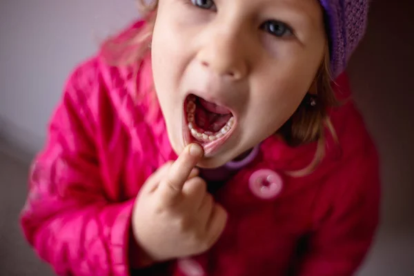 Erwachsene Zähne Die Sich Hinter Babyzähnen Verstecken Haifischzähne Geöffneter Mund — Stockfoto