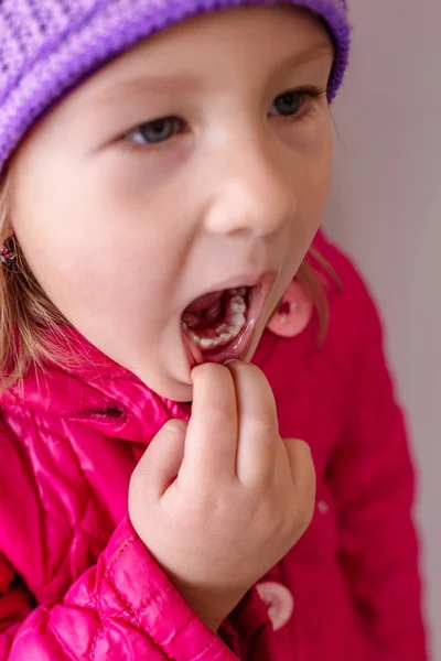 Dientes Permanentes Adultos Que Entran Detrás Los Dientes Bebé Dientes —  Fotos de Stock