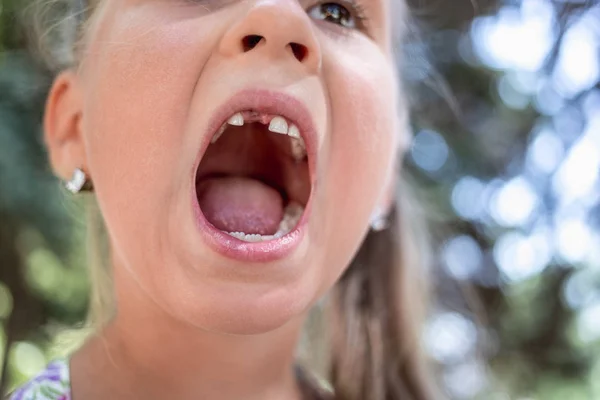 Retrato Cerca Una Niña Sin Diente —  Fotos de Stock