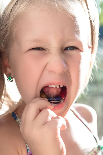 Menina Mostra Aparelho Ortodôntico Uma Criança Com Dentes Tortos Dente — Fotografia de Stock