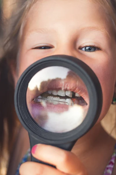 Mała Dziewczynka Położyć Szkło Powiększające Usta Pokazać Aparatów Ortodontycznych Krzywe — Zdjęcie stockowe