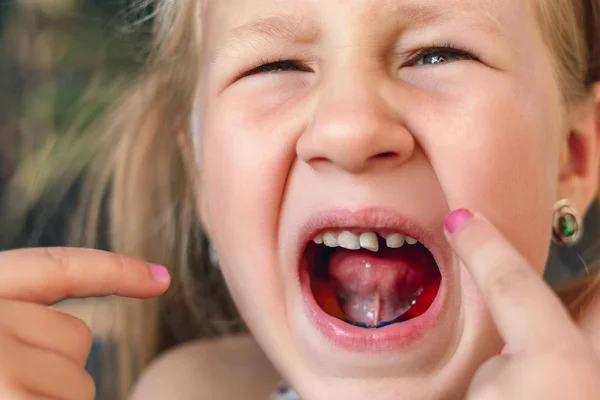 Niña Señala Con Dedo Diente Bebé Tambaleante — Foto de Stock