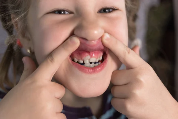 Dents Permanentes Adultes Devant Les Dents Bébé Enfant Dents Requin — Photo