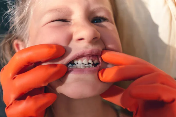 医者は矯正装置と曲がっている歯と小さな女の子の口の中を参照してくださいしようとしています グラグラの歯 — ストック写真