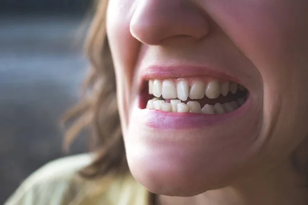 Photo of crooked woman teeth