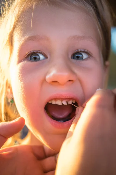 Process Removing Baby Tooth Using Thread — Stock Photo, Image