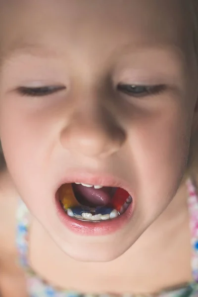 Uma Menina Com Dentes Tortos Mostra Aparelho Ortodôntico Boca — Fotografia de Stock