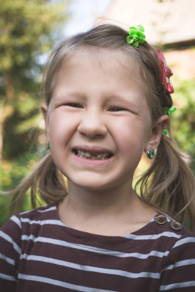 Criança Com Dispositivo Ortodôntico Dentário Sem Dente — Fotografia de Stock
