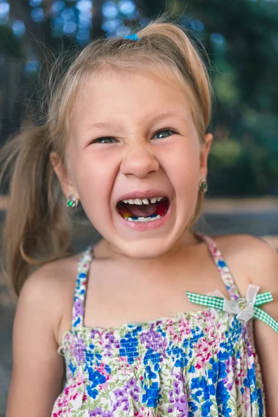 Dziewczynka Ortodoncją Krzywymi Zębami Chwiejny Ząb — Zdjęcie stockowe
