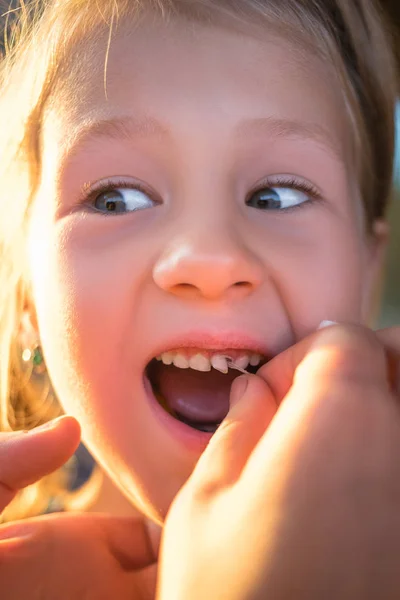 Het verwijderen van een baby tand met behulp van een draad — Stockfoto