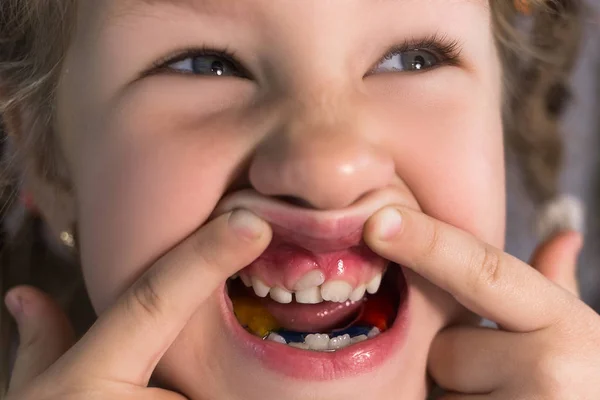 Dientes permanentes para adultos delante de los dientes de leche del niño : —  Fotos de Stock