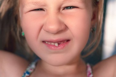 Sallanan bebek dişli küçük bir kızın portresi.