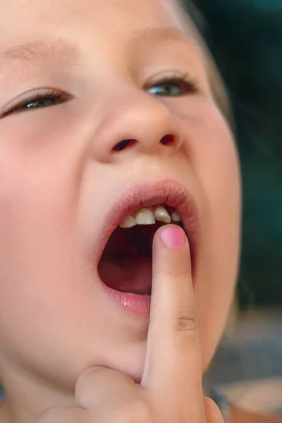 Niña señala con el dedo a un diente de bebé tambaleante —  Fotos de Stock