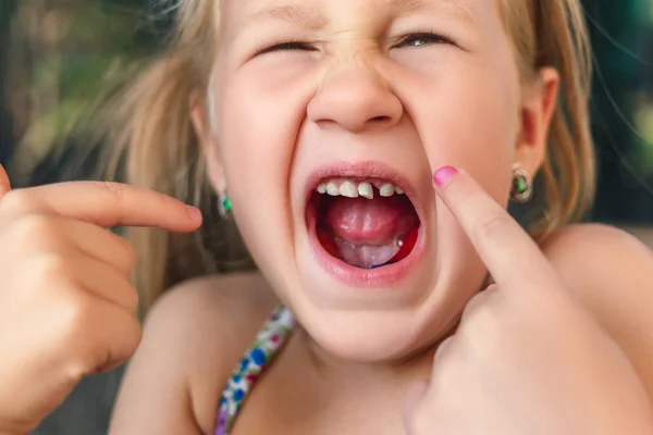 Niña señala con el dedo a un diente de bebé tambaleante —  Fotos de Stock