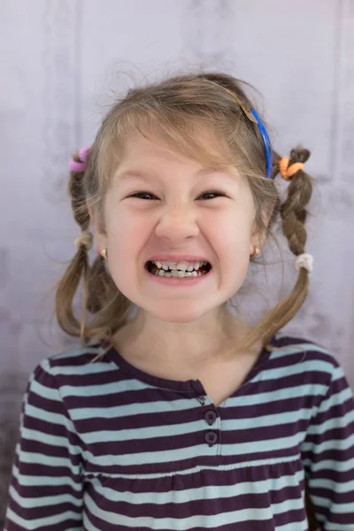 Dientes permanentes para adultos delante de los dientes de leche del niño : —  Fotos de Stock