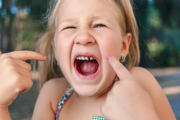 Niña señala con el dedo a un diente de bebé tambaleante —  Fotos de Stock