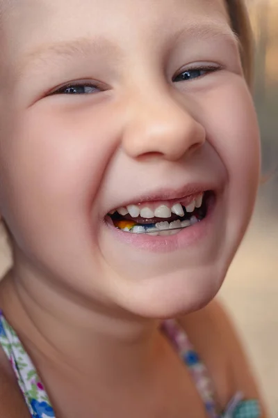 Dziewczynka z ortodoncji urządzenia i niepewny zęba — Zdjęcie stockowe