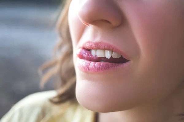 Foto gigi wanita yang bengkok — Stok Foto