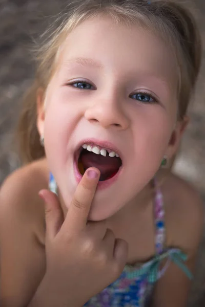 Little girl points the finger at a wobbly baby tooth — Stock Photo, Image