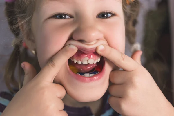 Dientes permanentes para adultos delante de los dientes de leche del niño : —  Fotos de Stock