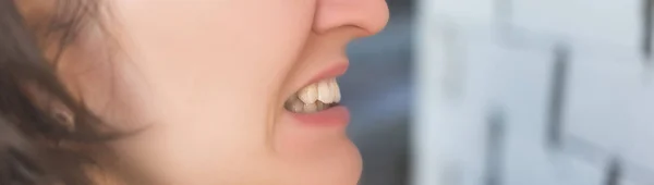 Foto de dentes de mulher torta — Fotografia de Stock