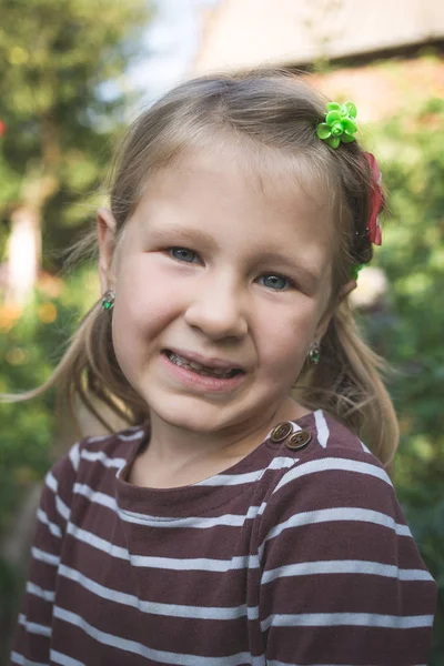 Kind mit kieferorthopädischem Gerät und ohne einen Zahn — Stockfoto