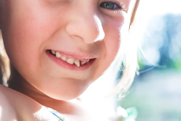 Retrato de una niña con un diente de bebé tambaleante —  Fotos de Stock