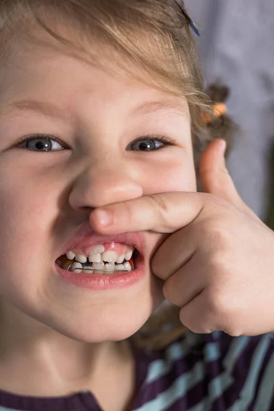 Adultos dentes permanentes que vêm na frente dos dentes de leite da criança : — Fotografia de Stock