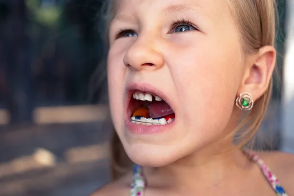 Kleines Mädchen mit Kieferorthopädie-Gerät und schiefen Zähnen. Wackelei — Stockfoto