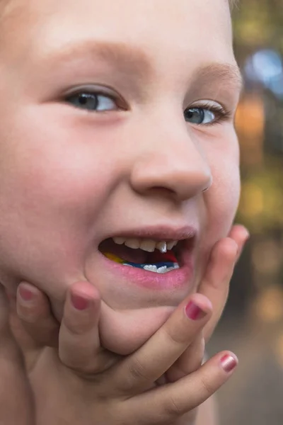 Klein meisje met orthodontie apparaat en kromme tanden. Wiebelen — Stockfoto