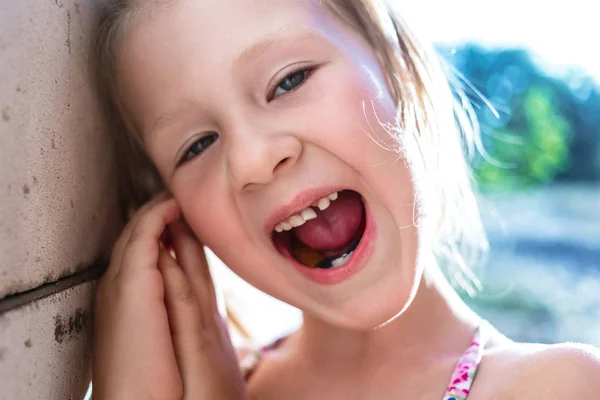 Kleines Mädchen mit schiefen Zähnen und kieferorthopädischem Gerät. — Stockfoto