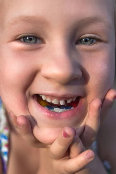 Niña con aparato de ortodoncia y dientes torcidos. Wobbl. —  Fotos de Stock