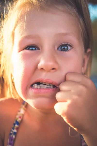 The process of removing a baby tooth using a thread — Stock Photo, Image