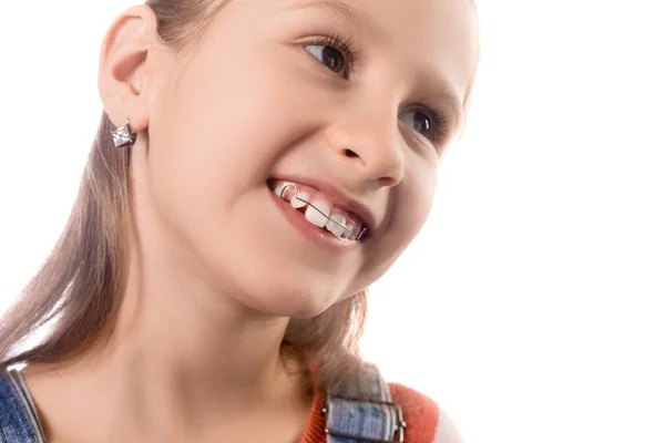 Retrato Niña Con Aparato Ortodoncia Aislado Sobre Fondo Blanco —  Fotos de Stock