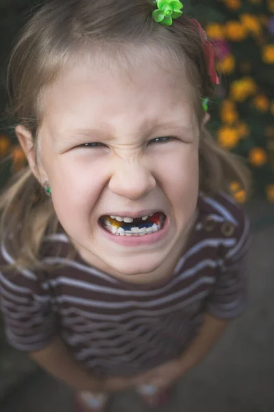 Niño Con Dispositivo Ortodoncia Dental Sin Diente —  Fotos de Stock