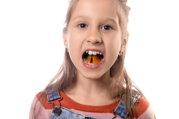 Retrato Niña Linda Muestra Aparato Ortodoncia Sobre Fondo Blanco — Foto de Stock