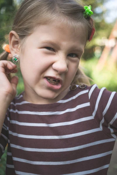 Criança Com Dispositivo Ortodôntico Dentário Sem Dente — Fotografia de Stock