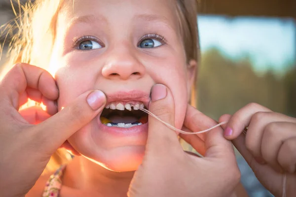 Proces Usuwania Zęba Niemowlęcego Pomocą Nici — Zdjęcie stockowe