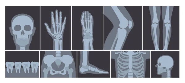 Ilustración vectorial del conjunto realista de muchas imágenes de rayos X del cuerpo humano. Fotos transparentes de rayos X sobre fondo blanco . — Vector de stock