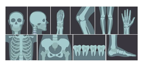 Conjunto de ilustración vectorial de muchas tomas de rayos X del cuerpo humano, imágenes de rayos X de la cabeza, las manos, las piernas y otras partes del cuerpo sobre fondo blanco . — Vector de stock