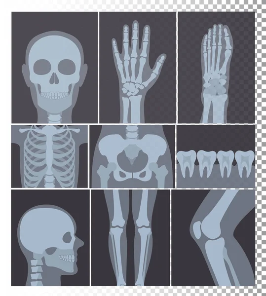 现实的 x 射线射击集合的向量例证。头部、骨骼、牙齿组、身体部位的 x 线照片设置在透明背景上. — 图库矢量图片