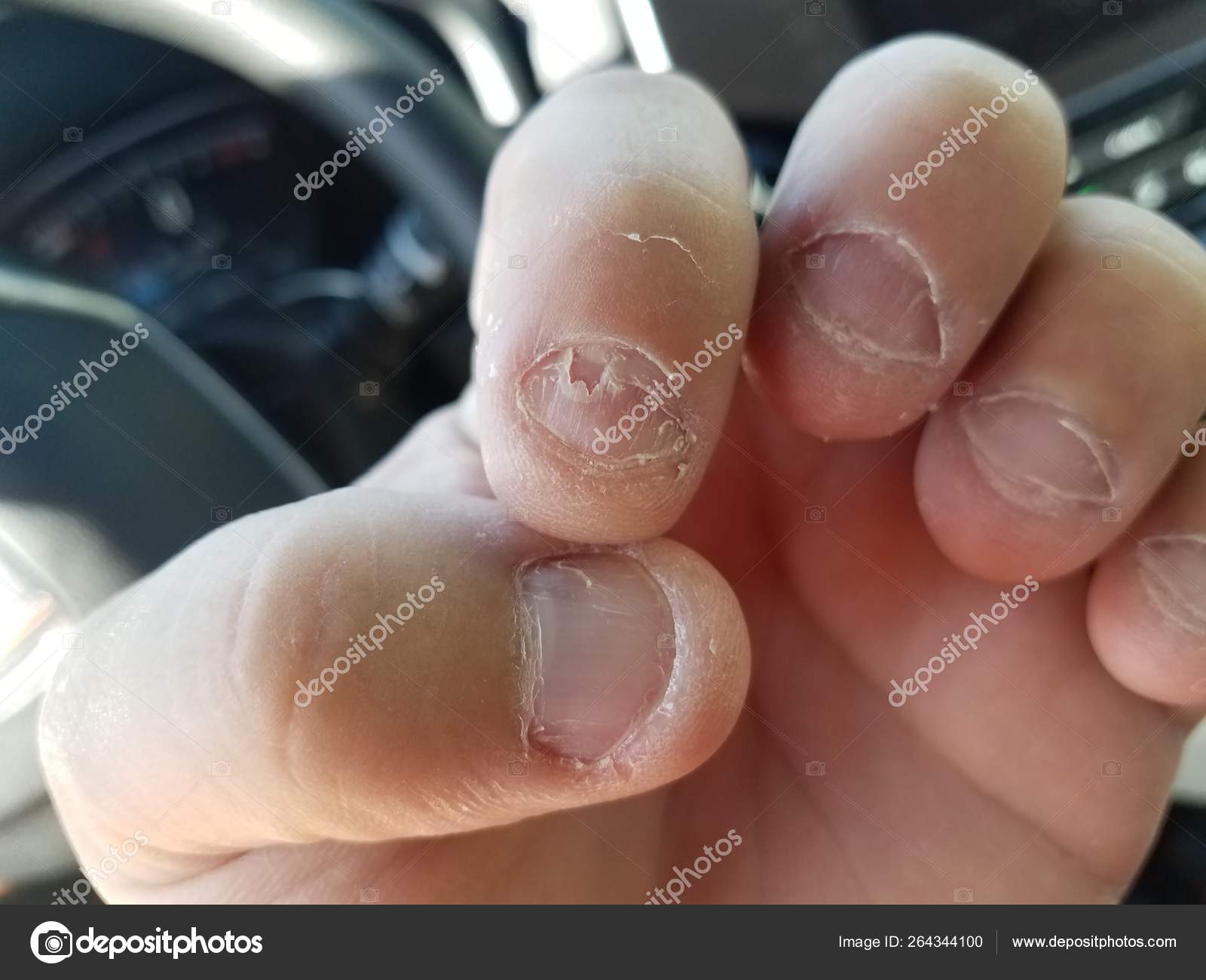 Close up of finger nail hi-res stock photography and images - Alamy