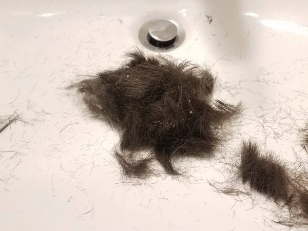 Capelli Castani Rasati Con Forfora Nel Lavandino Bianco Bagno — Foto Stock