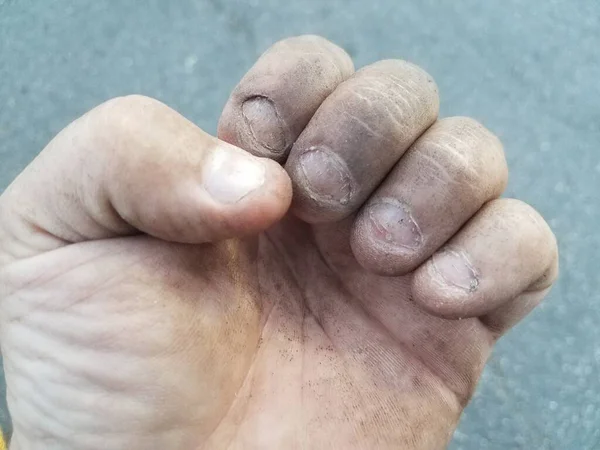 a dirty hand with dirt and disgusting bitten fingernails