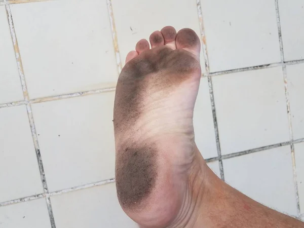 Schmutzige Und Schmutzige Füße Und Zehen Mit Weißem Fliesenboden — Stockfoto