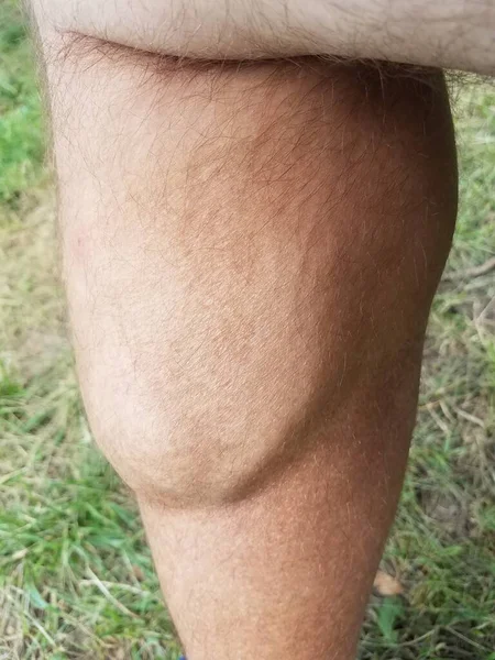 Large Flexed Calf Muscle Hairy Man Leg — Stock Photo, Image